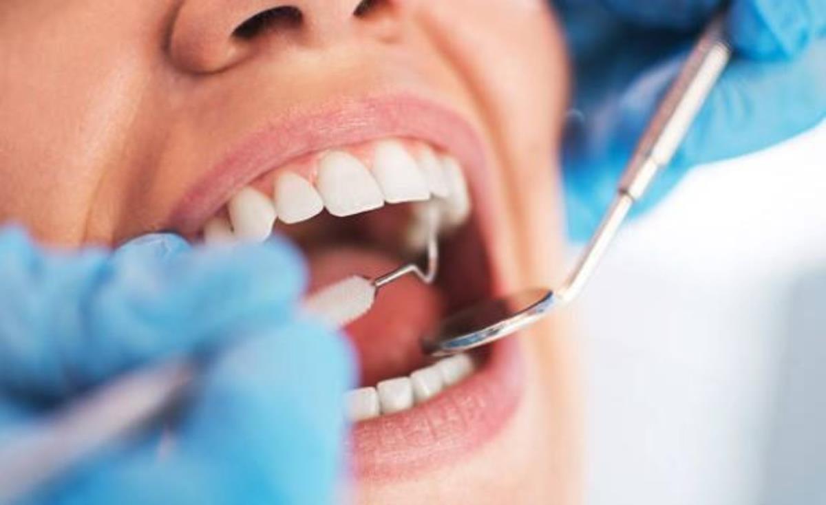 Kanal tedavisi nedir, nasıl yapılır? Kanal tedavisi ne kadar sürer, tekrar yapılabilir mi?
